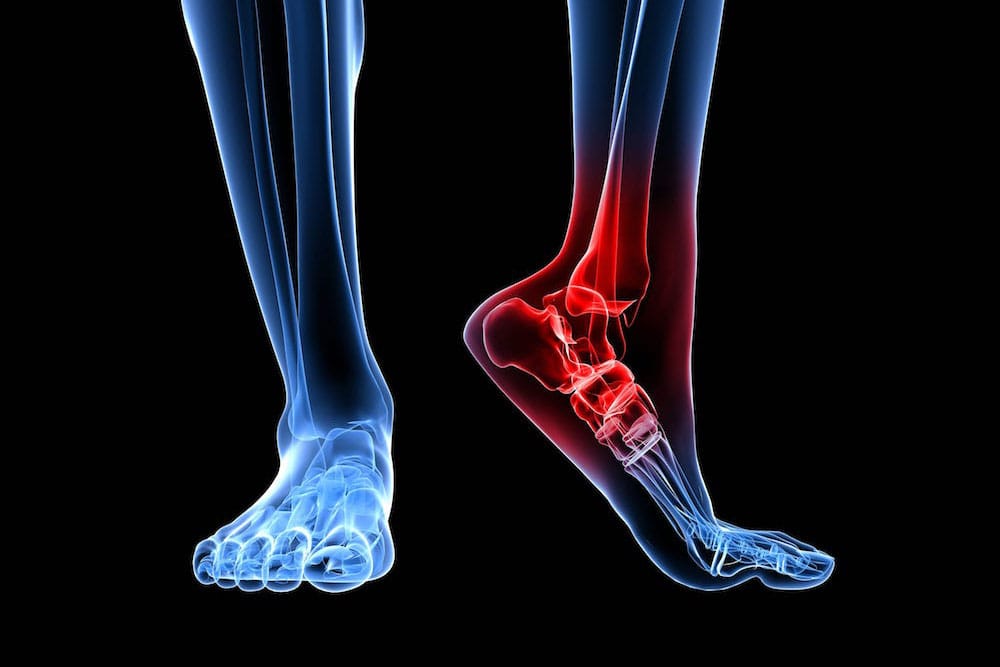 Foot & Ankle Trauma